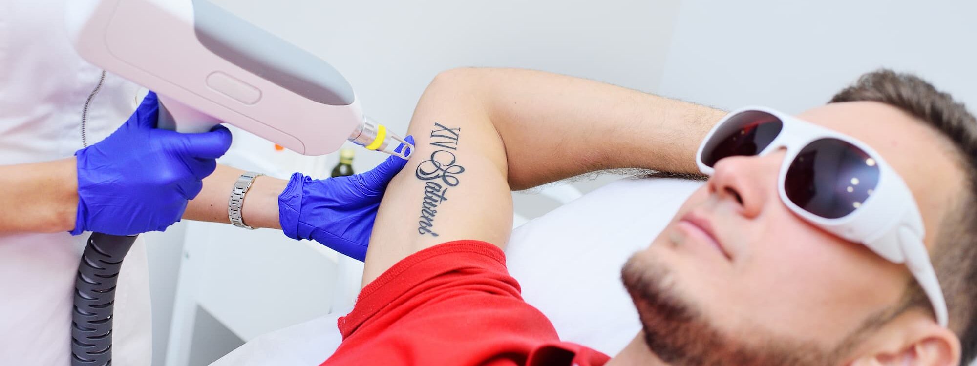 Détatouage au laser : Comment la couleur de l’encre influence-t-elle les résultats ? Colmar