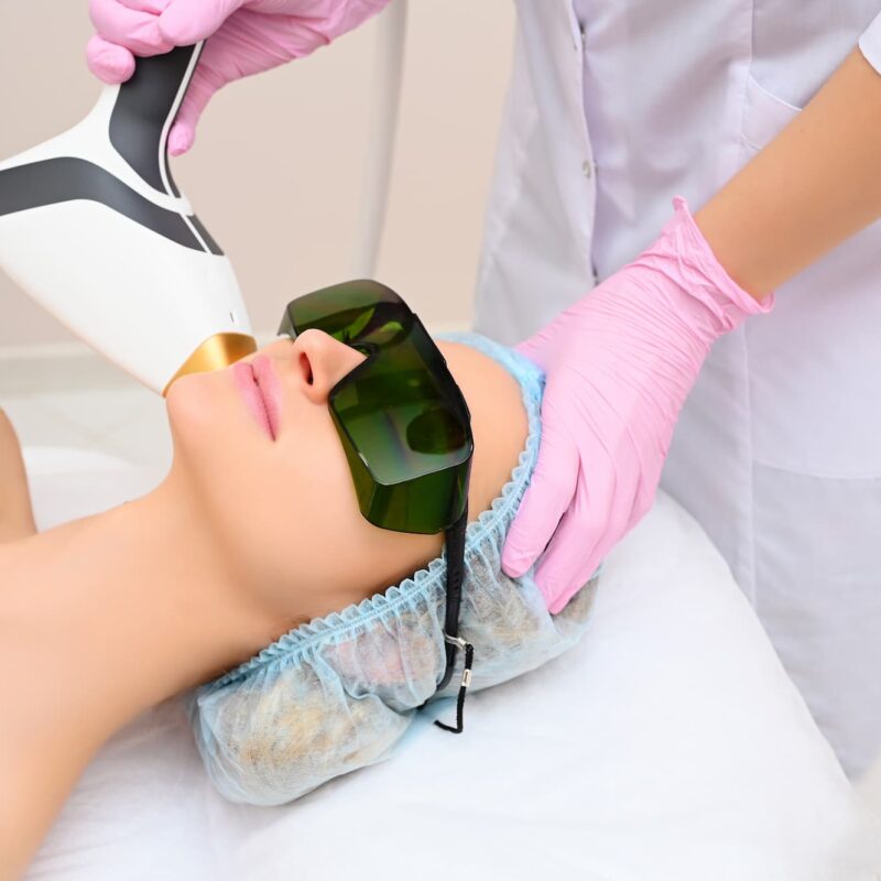Épilation laser : Quels sont les critères pour savoir si votre peau est adaptée ? Molsheim 2