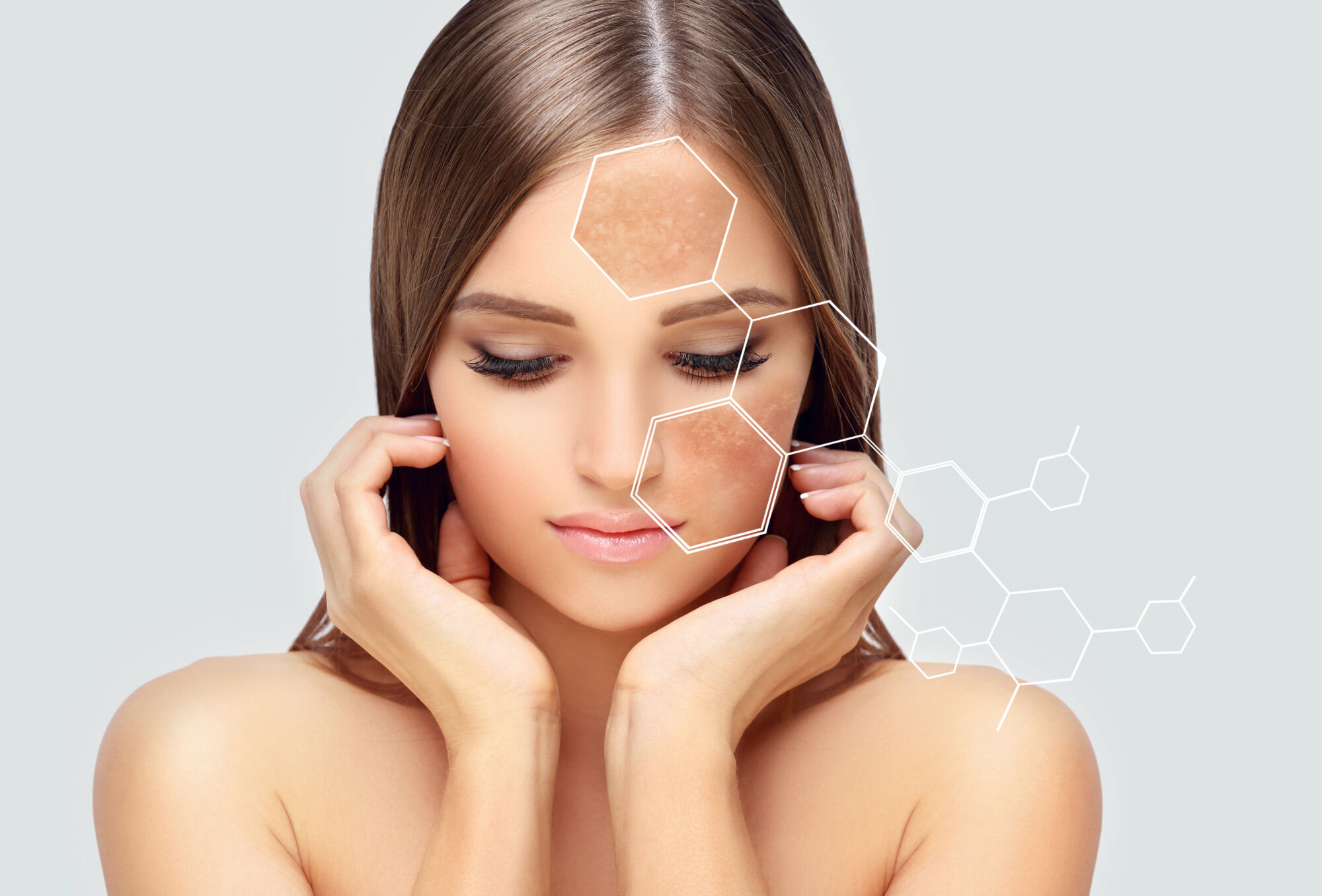 Quelles sont les différentes options de laser pour éliminer les taches brunes ? Sélestat