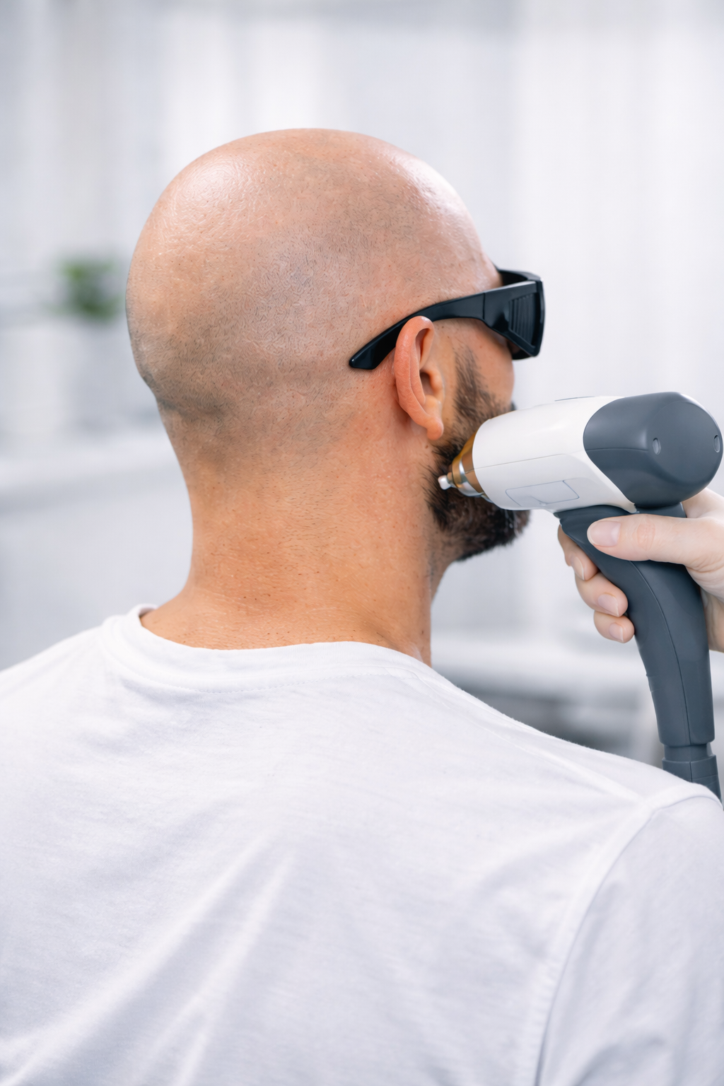 &Eacute;pilation laser chez l’homme &agrave; S&eacute;lestat : indications, zones et &eacute;volution des pratiques Fegersheim